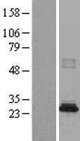NAT8B Human Over-expression Lysate