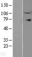 IPO11 Human Over-expression Lysate