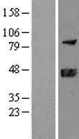 DNAJB11 Human Over-expression Lysate