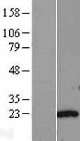 AK6 Human Over-expression Lysate