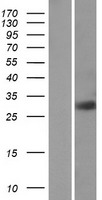 RAB23 Human Over-expression Lysate