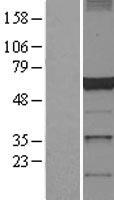 DCTN4 Human Over-expression Lysate