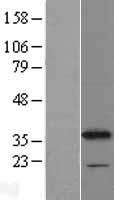 CYB5R1 Human Over-expression Lysate