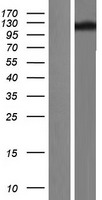 TRPC4 Human Over-expression Lysate