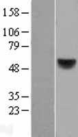 Retinoic Acid Receptor beta (RARB) Human Over-expression Lysate