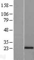 N acetyl transferase 5 (NAA20) Human Over-expression Lysate