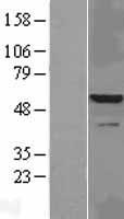 IRAK4 Human Over-expression Lysate