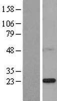 PSF2 (GINS2) Human Over-expression Lysate