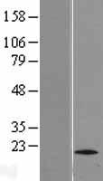 TTC11 (FIS1) Human Over-expression Lysate