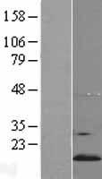 YPEL5 Human Over-expression Lysate