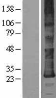 DERL2 Human Over-expression Lysate