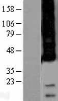 APH1A Human Over-expression Lysate