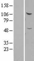 IFT52 Human Over-expression Lysate