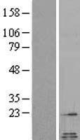 Galanin (GAL) Human Over-expression Lysate