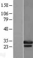Geminin (GMNN) Human Over-expression Lysate