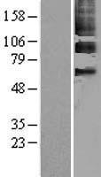 PPAR gamma (PPARG) Human Over-expression Lysate