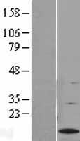 G0S2 Human Over-expression Lysate