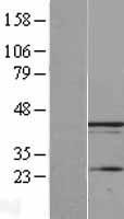 UBXN1 Human Over-expression Lysate