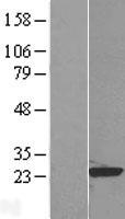 RAP1B Human Over-expression Lysate