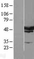 SERBP1 Human Over-expression Lysate