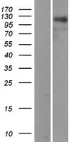 RAI14 Human Over-expression Lysate