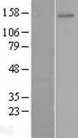 ZNF521 Human Over-expression Lysate