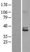 POLDIP2 Human Over-expression Lysate