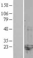 CNRIP1 Human Over-expression Lysate