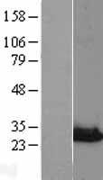 NIPSNAP3A Human Over-expression Lysate
