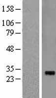 Pirh2 (RCHY1) Human Over-expression Lysate