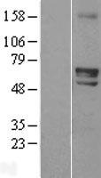ZIM2 Human Over-expression Lysate