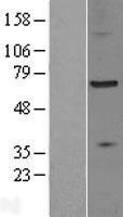 ZDHHC17 Human Over-expression Lysate