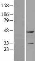 DULLARD (CTDNEP1) Human Over-expression Lysate