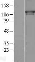 FAM62A (ESYT1) Human Over-expression Lysate