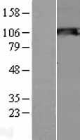 Snf1lk2 (SIK2) Human Over-expression Lysate