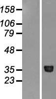 Methionyl Aminopeptidase 1 (METAP1) Human Over-expression Lysate