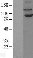 KDM1A Human Over-expression Lysate