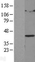 LPGAT1 Human Over-expression Lysate