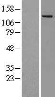 KDM4A Human Over-expression Lysate