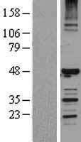 HERPUD1 Human Over-expression Lysate