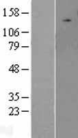 ULK2 Human Over-expression Lysate