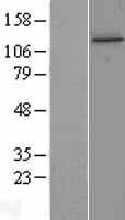 TTI1 Human Over-expression Lysate