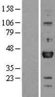 OTX1 Human Over-expression Lysate