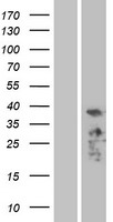 ALP (PDLIM3) Human Over-expression Lysate