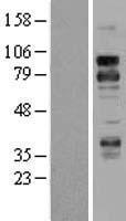DR6 (TNFRSF21) Human Over-expression Lysate