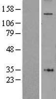 AFF4 Human Over-expression Lysate