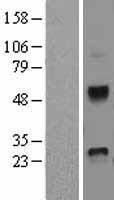 DKK4 Human Over-expression Lysate