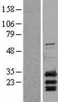 Bcl2 Binding component 3 (BBC3) Human Over-expression Lysate