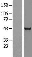 KLHDC2 Human Over-expression Lysate