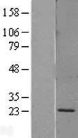 SEC11A Human Over-expression Lysate